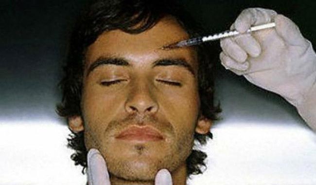 Ένεση botox